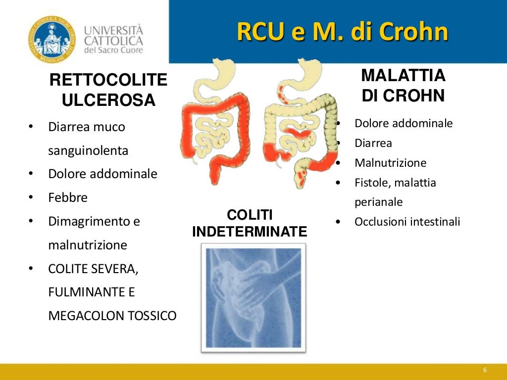 Malattia Infettiva Intestinale Cruciverba Malattie infiammatorie intestinali