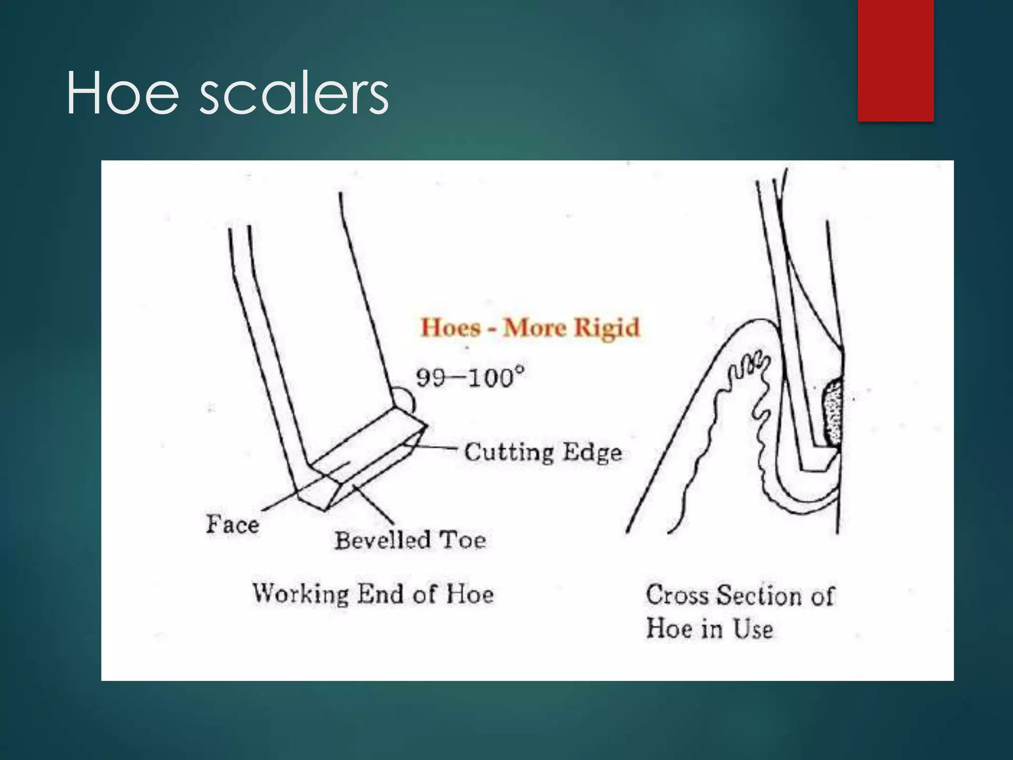 scaling and root planing instruments | PDF