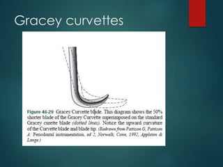 Gracey curvettes
 