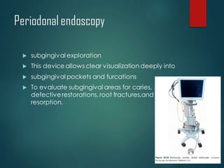 Periodonalendoscopy
 subgingival exploration
 This device allows clear visualization deeply into
 subgingival pockets and furcations
 To evaluate subgingival areas for caries,
defectiverestorations, root fractures,and
resorption.
 