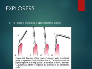 EXPLORERS
 to locate calculus depositesand caries
 