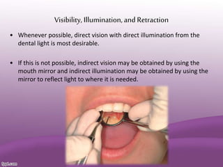 Visibility, Illumination,and Retraction
• Whenever possible, direct vision with direct illumination from the
dental light is most desirable.
• If this is not possible, indirect vision may be obtained by using the
mouth mirror and indirect illumination may be obtained by using the
mirror to reflect light to where it is needed.
 