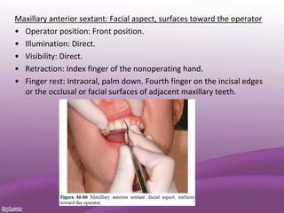 Maxillary anterior sextant: Facial aspect, surfaces toward the operator
• Operator position: Front position.
• Illumination: Direct.
• Visibility: Direct.
• Retraction: Index finger of the nonoperating hand.
• Finger rest: Intraoral, palm down. Fourth finger on the incisal edges
or the occlusal or facial surfaces of adjacent maxillary teeth.
 