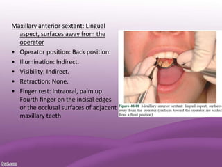 Maxillary anterior sextant: Lingual
aspect, surfaces away from the
operator
• Operator position: Back position.
• Illumination: Indirect.
• Visibility: Indirect.
• Retraction: None.
• Finger rest: Intraoral, palm up.
Fourth finger on the incisal edges
or the occlusal surfaces of adjacent
maxillary teeth
 