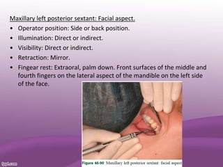 Maxillary left posterior sextant: Facial aspect.
• Operator position: Side or back position.
• Illumination: Direct or indirect.
• Visibility: Direct or indirect.
• Retraction: Mirror.
• Fingear rest: Extraoral, palm down. Front surfaces of the middle and
fourth fingers on the lateral aspect of the mandible on the left side
of the face.
 
