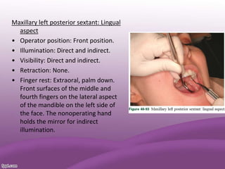 Maxillary left posterior sextant: Lingual
aspect
• Operator position: Front position.
• Illumination: Direct and indirect.
• Visibility: Direct and indirect.
• Retraction: None.
• Finger rest: Extraoral, palm down.
Front surfaces of the middle and
fourth fingers on the lateral aspect
of the mandible on the left side of
the face. The nonoperating hand
holds the mirror for indirect
illumination.
 