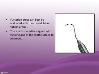 • Furcation areas can best be
evaluated with the curved, blunt
Nabers probe .
• The shank should be aligned with
the long axis of the tooth surface to
be probed.
 