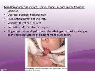 Mandibular anterior sextant: Lingual aspect, surfaces away from the
operator
• Operator position: Back position.
• Illumination: Direct and indirect.
• Visibility: Direct and indirect.
• Retraction: Mirror retracts tongue.
• Finger rest: Intraoral, palm down. Fourth finger on the incisal edges
or the occlusal surfaces of adjacent mandibular teeth.
 