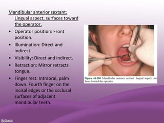 Mandibular anterior sextant:
Lingual aspect, surfaces toward
the operator.
• Operator position: Front
position.
• Illumination: Direct and
indirect.
• Visibility: Direct and indirect.
• Retraction: Mirror retracts
tongue.
• Finger rest: Intraoral, palm
down. Fourth finger on the
incisal edges or the occlusal
surfaces of adjacent
mandibular teeth.
 
