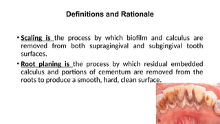 Root Planning Process scaling and root planning lecture(1).pptx