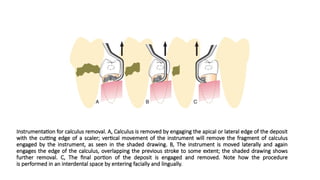 scaling and root planning lecture(1).pptx