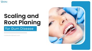 Scaling and Root Planing for Gum Disease