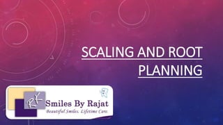 SCALING AND ROOT
PLANNING
 