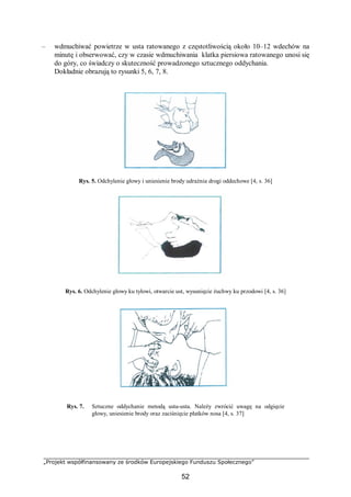 „Projekt współfinansowany ze środków Europejskiego Funduszu Społecznego”
52
– wdmuchiwać powietrze w usta ratowanego z częstotliwością około 10–12 wdechów na
minutę i obserwować, czy w czasie wdmuchiwania klatka piersiowa ratowanego unosi się
do góry, co świadczy o skuteczność prowadzonego sztucznego oddychania.
Dokładnie obrazują to rysunki 5, 6, 7, 8.
Rys. 5. Odchylenie głowy i uniesienie brody udrażnia drogi oddechowe [4, s. 36]
Rys. 6. Odchylenie głowy ku tyłowi, otwarcie ust, wysunięcie żuchwy ku przodowi [4, s. 36]
Rys. 7. Sztuczne oddychanie metodą usta-usta. Należy zwrócić uwagę na odgięcie
głowy, uniesienie brody oraz zaciśnięcie płatków nosa [4, s. 37]
 