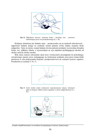 „Projekt współfinansowany ze środków Europejskiego Funduszu Społecznego”
53
Rys. 8. Oddychanie usta-nos: uniesiona broda i zaciśnięte usta – powietrze
wdmuchujemy przez nos poszkodowanego [4, s. 38]
Kolejnym elementem jest badanie tętna – przeprowadza się na tętnicach obwodowych –
najprostsze badanie polega na uciskaniu trzema palcami rowka między ścianami około
nadgarstka. Tętno na tętnicy szyjnej badamy dwoma palcami pomiędzy wyczuwalną chrząstką
krtani, tzw. jabłkiem Adama, a wyczuwalnym na szyi mięśniem przebiegającym ukośnie od
okolicy ucha do okolicy mostka.
Brak tętna oznacza zatrzymanie akcji serca i konieczność przystąpienia do pośredniego,
zewnętrznego masażu serca, polegającego na rytmicznym uciskaniu serca przez ścianę klatki
piersiowej w celu podtrzymania krążenia i pompowania krwi do ważnych życiowo organów.
Przedstawia to rysunek 9, 10, 11.
Rys. 9. Ucisk mostka należy wykonywać wyprostowanymi rękami, ułożonymi
jedna na drugiej z dłońmi mocno zagiętymi w stawie nadgarstkowym [4, s.
40 ]
 