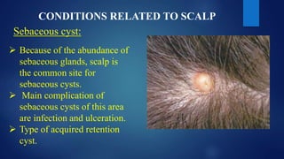 CONDITIONS RELATED TO SCALP
 Because of the abundance of
sebaceous glands, scalp is
the common site for
sebaceous cysts.
 Main complication of
sebaceous cysts of this area
are infection and ulceration.
 Type of acquired retention
cyst.
Sebaceous cyst:
 