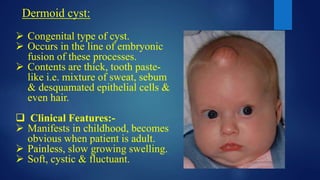 Dermoid cyst:
 Congenital type of cyst.
 Occurs in the line of embryonic
fusion of these processes.
 Contents are thick, tooth paste-
like i.e. mixture of sweat, sebum
& desquamated epithelial cells &
even hair.
 Clinical Features:-
 Manifests in childhood, becomes
obvious when patient is adult.
 Painless, slow growing swelling.
 Soft, cystic & fluctuant.
 