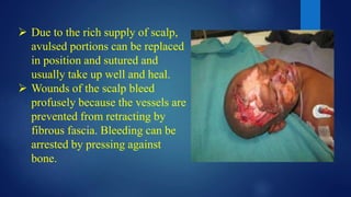  Due to the rich supply of scalp,
avulsed portions can be replaced
in position and sutured and
usually take up well and heal.
 Wounds of the scalp bleed
profusely because the vessels are
prevented from retracting by
fibrous fascia. Bleeding can be
arrested by pressing against
bone.
 
