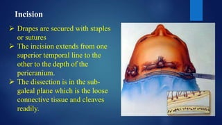 Incision
 Drapes are secured with staples
or sutures
 The incision extends from one
superior temporal line to the
other to the depth of the
pericranium.
 The dissection is in the sub-
galeal plane which is the loose
connective tissue and cleaves
readily.
 