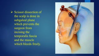  Scissor dissection of
the scalp is done in
subgaleal plane
which prevents the
surgeon from
incising the
temporalis fascia
and the muscle
which bleeds freely.
 