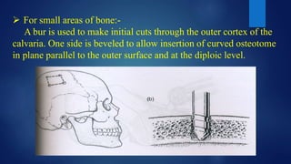  For small areas of bone:-
A bur is used to make initial cuts through the outer cortex of the
calvaria. One side is beveled to allow insertion of curved osteotome
in plane parallel to the outer surface and at the diploic level.
 