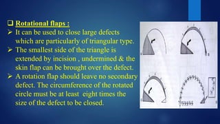  Rotational flaps :
 It can be used to close large defects
which are particularly of triangular type.
 The smallest side of the triangle is
extended by incision , undermined & the
skin flap can be brought over the defect.
 A rotation flap should leave no secondary
defect. The circumference of the rotated
circle must be at least eight times the
size of the defect to be closed.
 