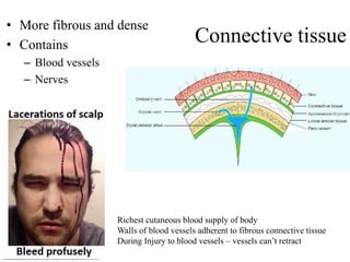 Connective tissue
• More fibrous and dense
• Contains
– Blood vessels
– Nerves
Richest cutaneous blood supply of body
Walls of blood vessels adherent to fibrous connective tissue
During Injury to blood vessels – vessels can’t retract
 