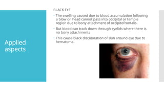 Applied
aspects
BLACK EYE
 The swelling caused due to blood accumulation following
a blow on head cannot pass into occipital or temple
region due to bony attachment of occipitofrontalis.
 But blood can track down through eyelids where there is
no bony attachments
 This cause black discoloration of skin around eye due to
hematoma.
 