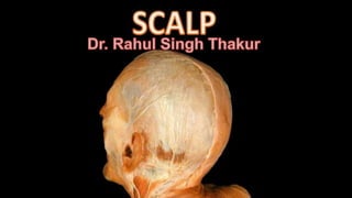 Scalp Anatomy  - Dr. Rahul Singh Thakur