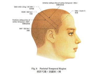 scalp acupuncture