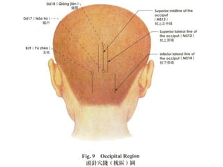 scalp acupuncture
