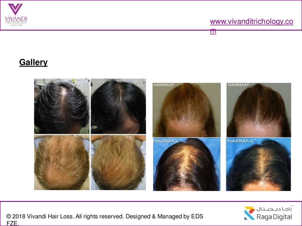 Scalp Care Treatment Dubai
