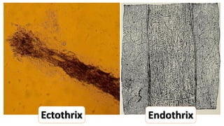 Scalp Diseases (New Version).pptx scalppp | PPTX