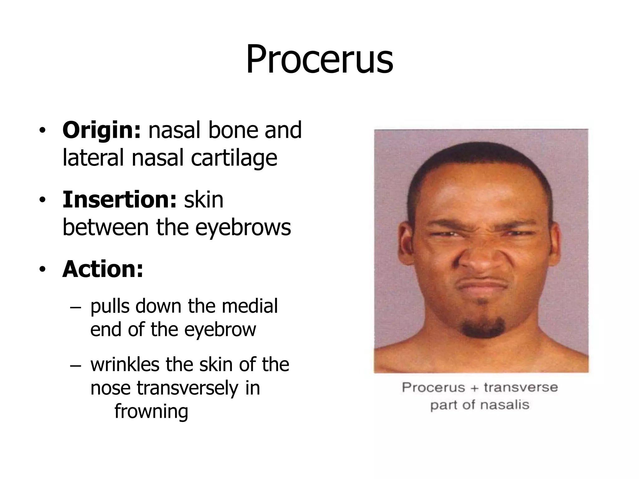 Procerus
• Origin: nasal bone and
lateral nasal cartilage
• Insertion: skin
between the eyebrows
• Action:
– pulls down the medial
end of the eyebrow
– wrinkles the skin of the
nose transversely in
frowning
 