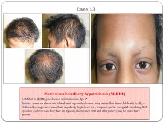 Comprehensive Overview of Scalp Lesions: Diagnosis and Clinical ...