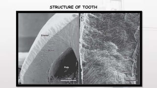 STRUCTURE OF TOOTH
 