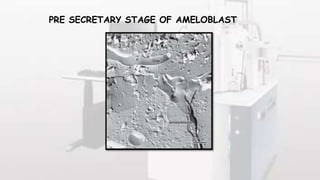 PRE SECRETARY STAGE OF AMELOBLAST
 