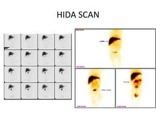 HIDA SCAN
 