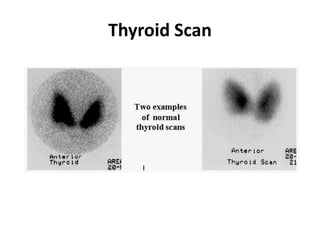 Thyroid Scan
 
