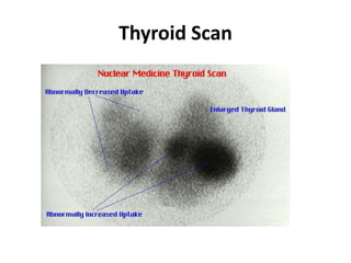 Thyroid Scan
 