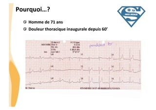 CHU_Hôpitaux de Rouen - page 6
Pourquoi…?	
  
  Homme	
  de	
  71	
  ans	
  
  Douleur	
  thoracique	
  inaugurale	
  depuis	
  60’	
  
 
