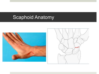 Scaphoid - Tips to fix Scaphoid fractures & Non union management | PPTX
