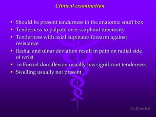 Scaphoid fracture (2)