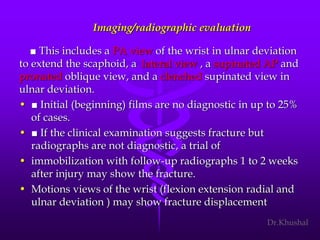 Scaphoid fracture (2)