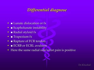 Scaphoid fracture (2)