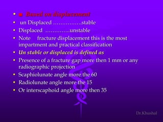 Scaphoid fracture (2)