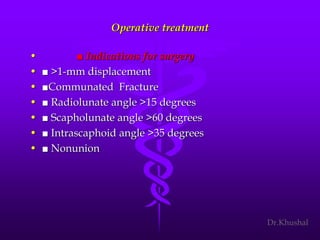 Scaphoid fracture (2)