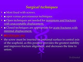 Scaphoid fracture (2)