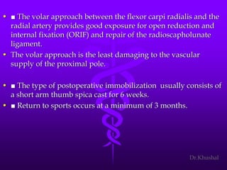 Scaphoid fracture (2)
