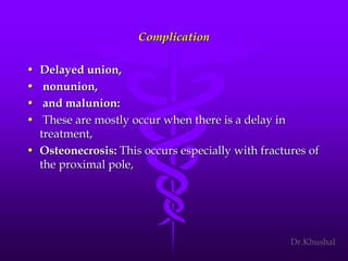 Scaphoid fracture (2)